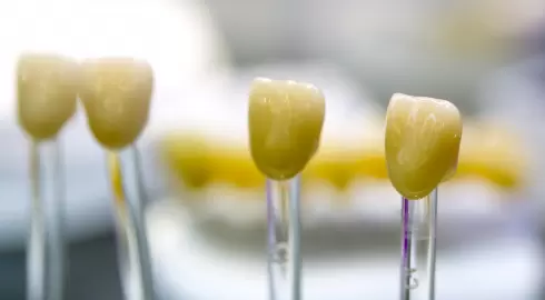 Ucuza İmplant nasıl yaptırabilirim ?